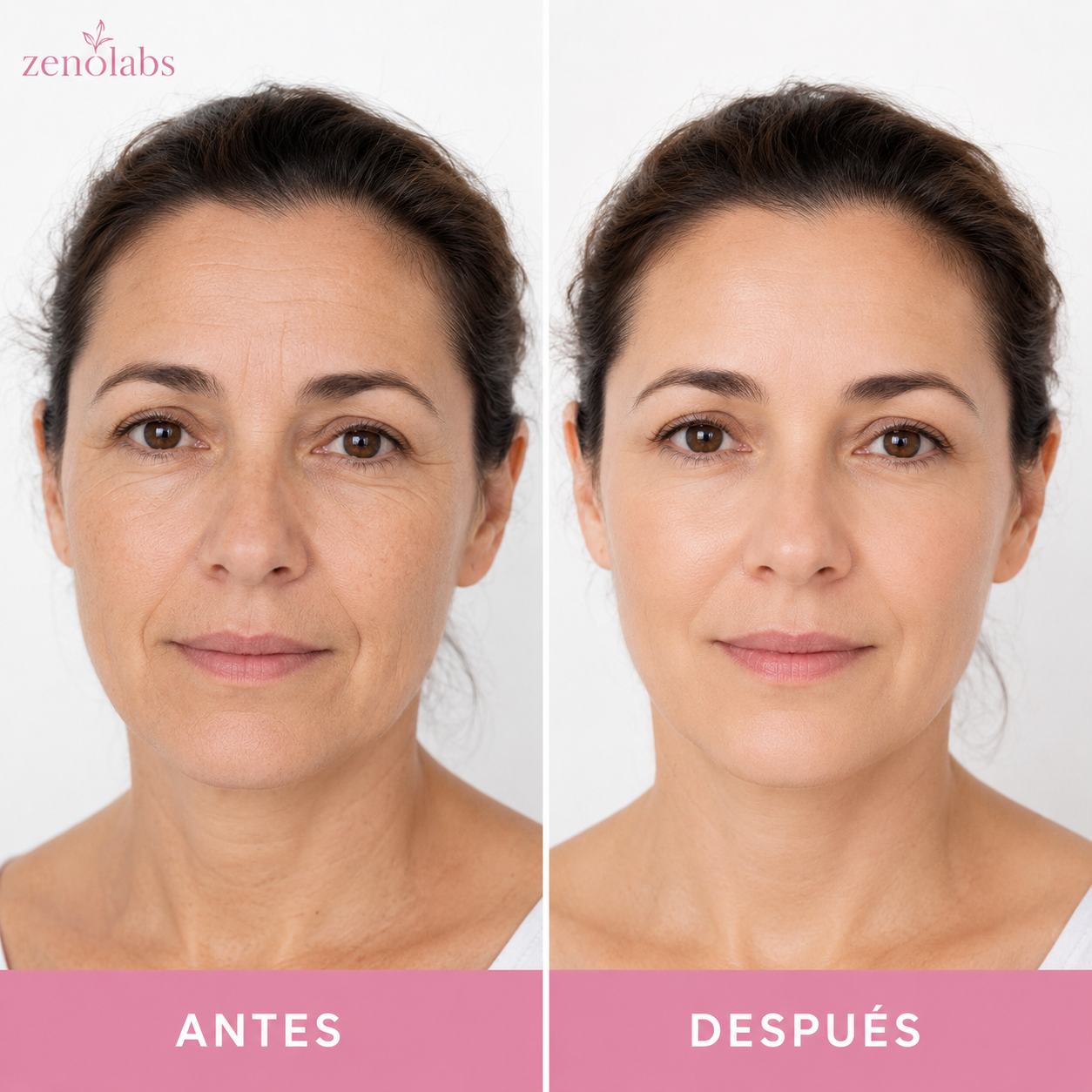 Bálsamo Antiarrugas - Reduce Arrugas y Líneas de Expresión