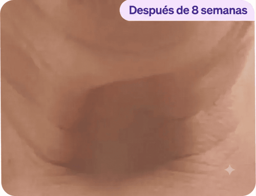 Después - Lorena M.