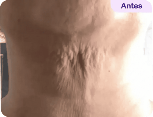 Antes - Aileen C.