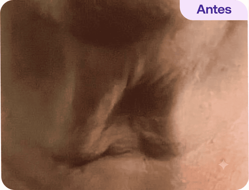 Antes - Lorena M.