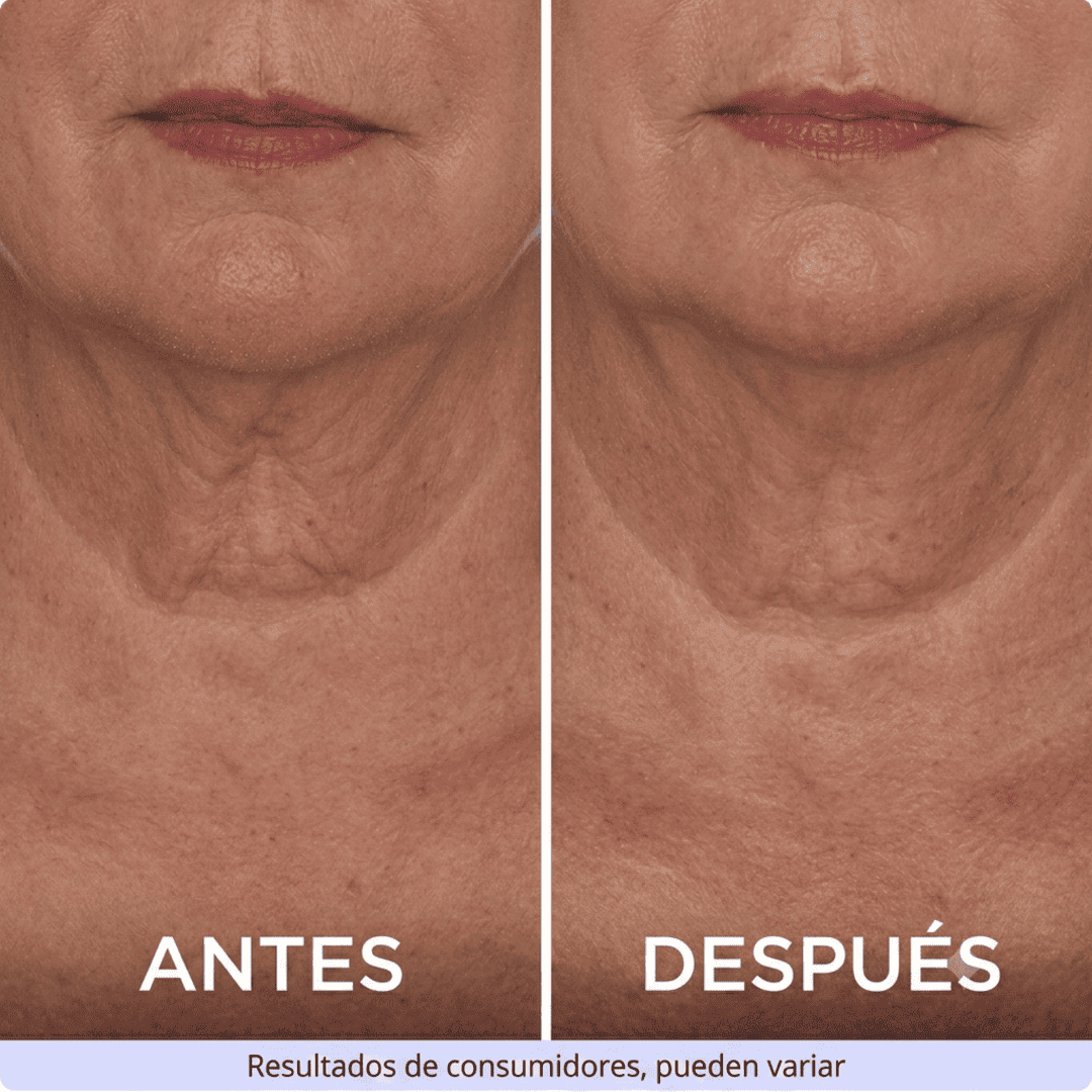 ZenoLabs™ Decile Adiós a las Arrugas del Cuello y Volvé a Sentirte Joven y Segura