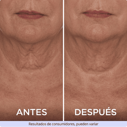 ZenoLabs™ Decile Adiós a las Arrugas del Cuello y Volvé a Sentirte Joven y Segura