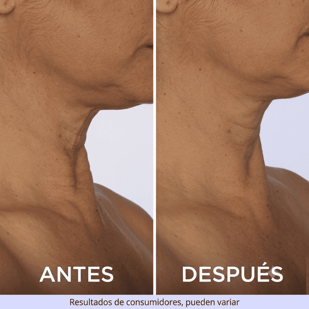 ZenoLabs™ Decile Adiós a las Arrugas del Cuello y Volvé a Sentirte Joven y Segura