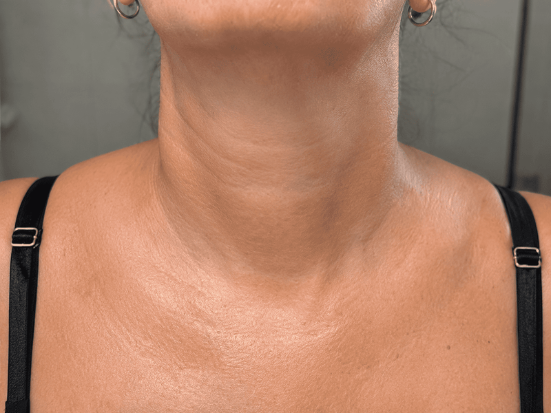 Tu cuello empieza a cambiar