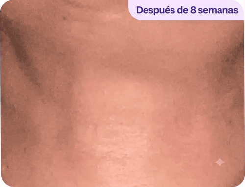 Después - Pilar R.